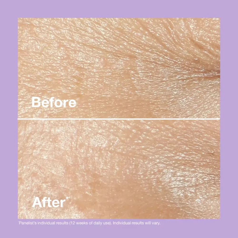 Clinique Smart Clinical Repair™ Wrinkle Correcting Cream 50ml