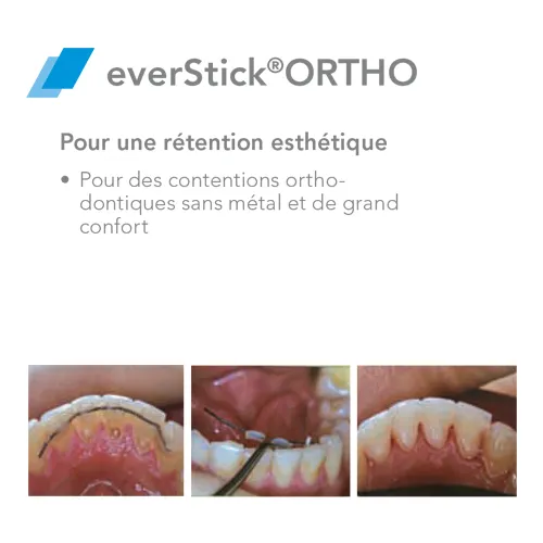 EverStick ORTHO Fibre de verre - GC