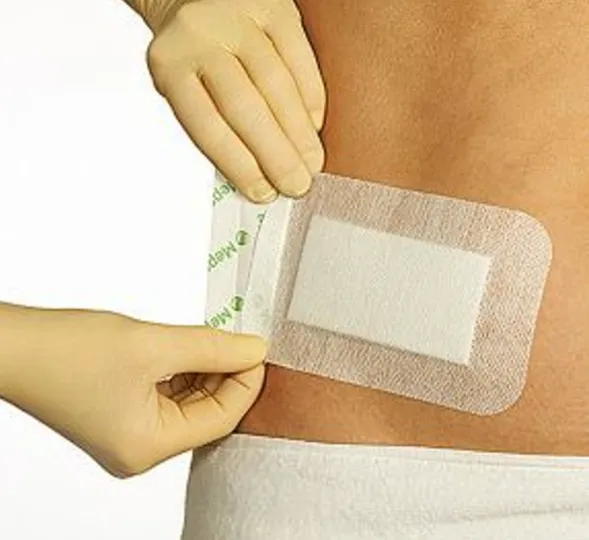 Molnlycke Mepore Self -stick absorption dressing pad is suitable for surgical incision slightly burns and scratching Self Adhesive Absorbent Dressings