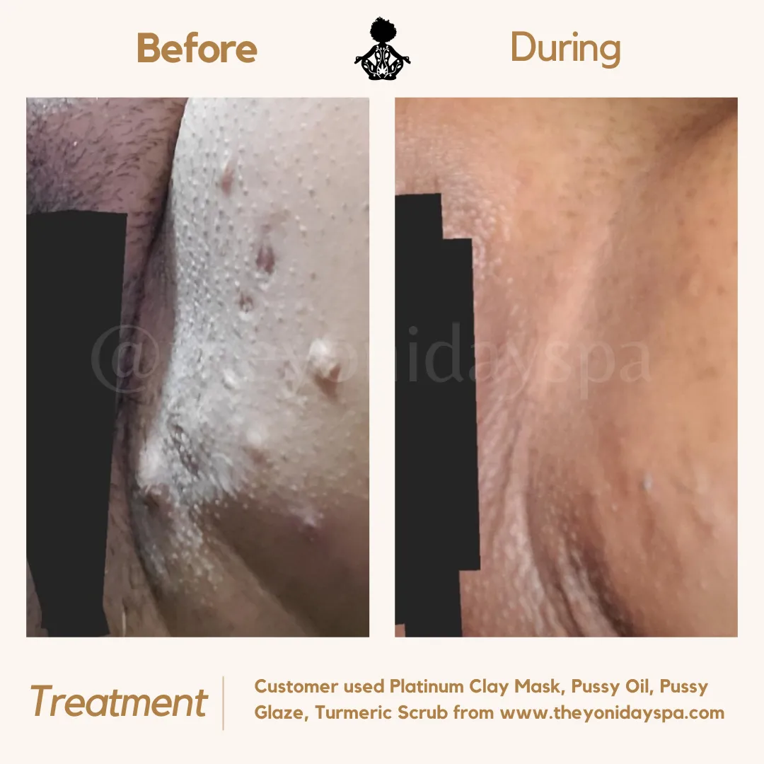 Platinum Clay Mask